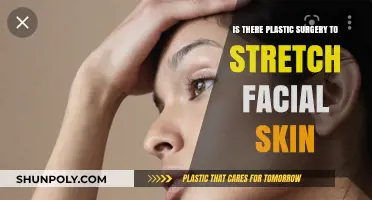 Facial Skin Stretching: Exploring Plastic Surgery Options and Procedures