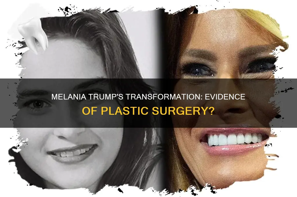 is there proof that melania trump had plastic surgery