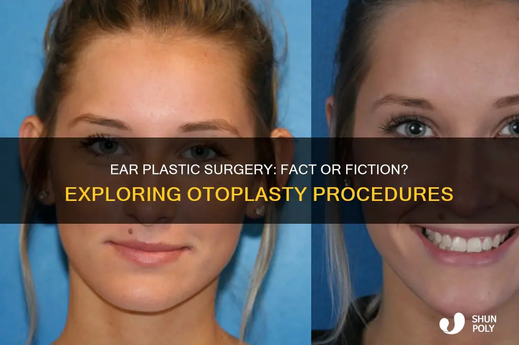 is there such a thing as ear plastic surgery