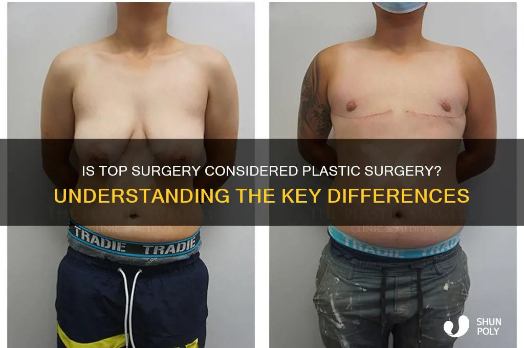 is top surgery plastic surgery