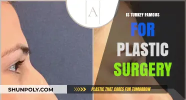 Turkey's Rise as a Global Hub for Plastic Surgery: Fact or Fiction?