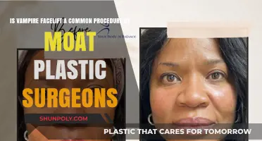 Is Vampire Facelift Widely Performed by Most Plastic Surgeons?