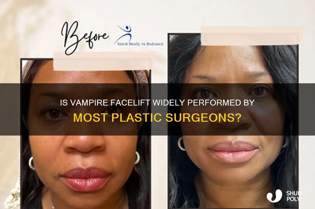 is vampire facelift a common procedure by moat plastic surgeons