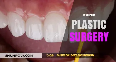 Are Veneers Considered Plastic Surgery? Unraveling Dental Cosmetic Procedures