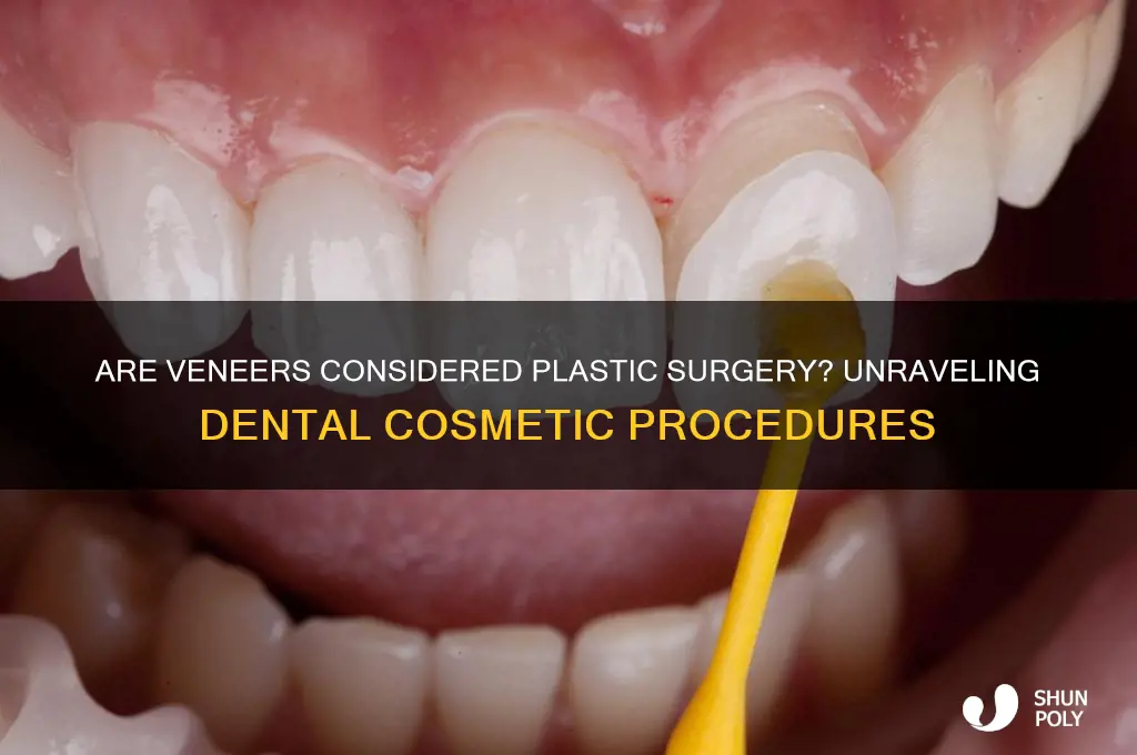 is veneers plastic surgery