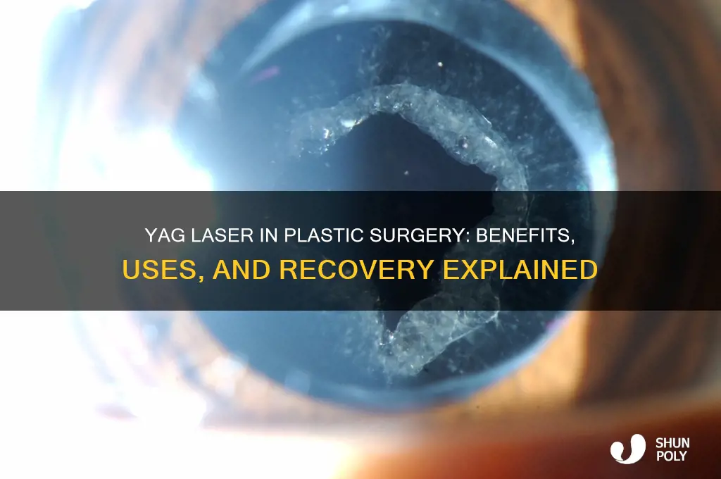 is yag laser plastic surgery