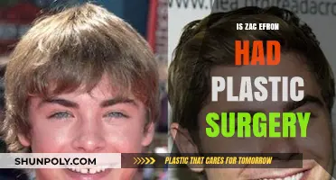 Zac Efron's Transformation: Plastic Surgery Rumors Explored and Debunked