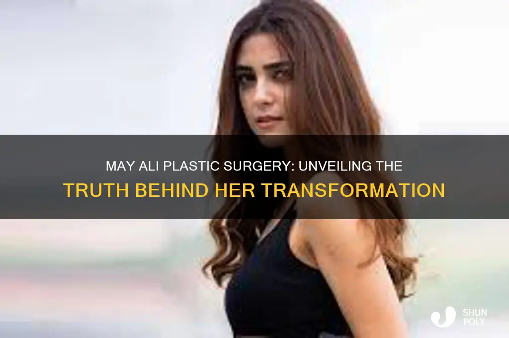 may ali plastic surgery