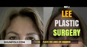 May J. Lee's Plastic Surgery Transformation: Truths and Speculations