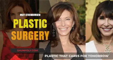 May Steenburgen's Plastic Surgery: Unveiling the Truth Behind Her Timeless Look