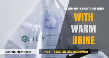 Unusual Bond: My Strange Attachment to a Warm Urine-Filled Plastic Bag