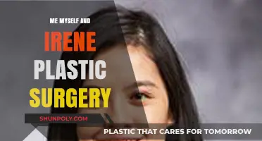 Me, Myself, and Irene: Unveiling the Plastic Surgery Transformation