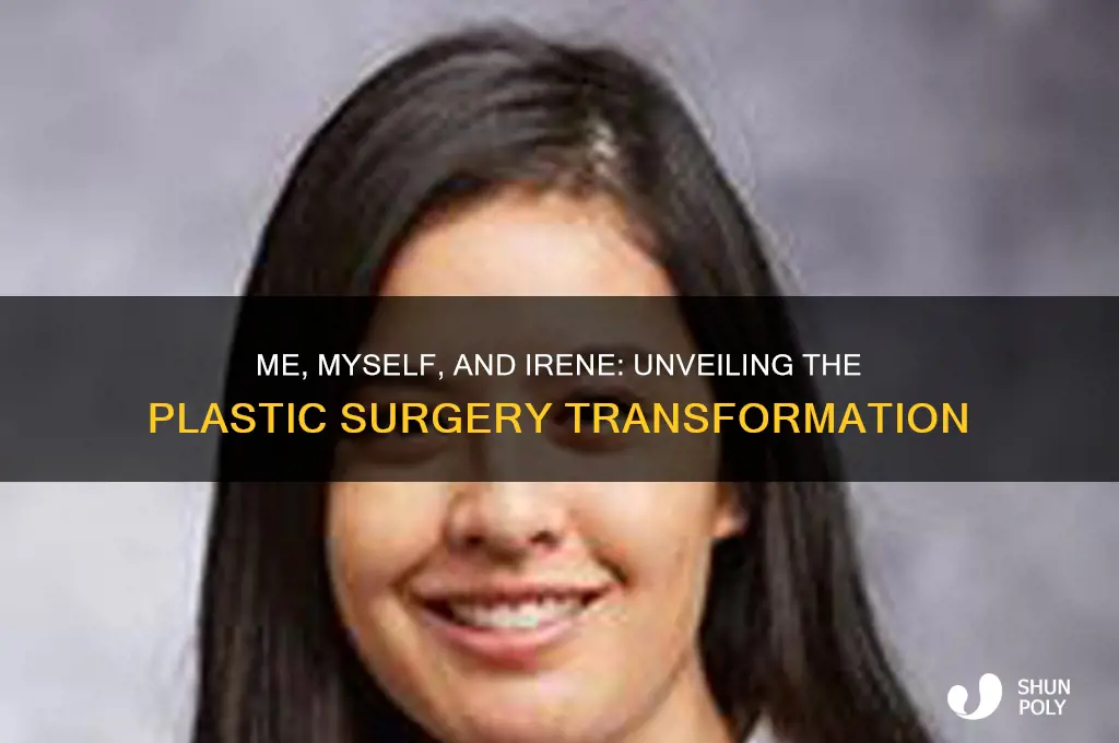 me myself and irene plastic surgery