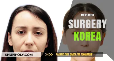 Transforming Beauty: My Plastic Surgery Journey in Korea Revealed