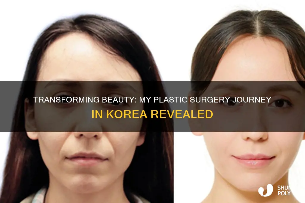 me plastic surgery korea