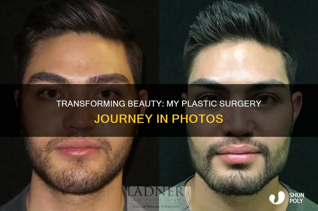me plastic surgery photos