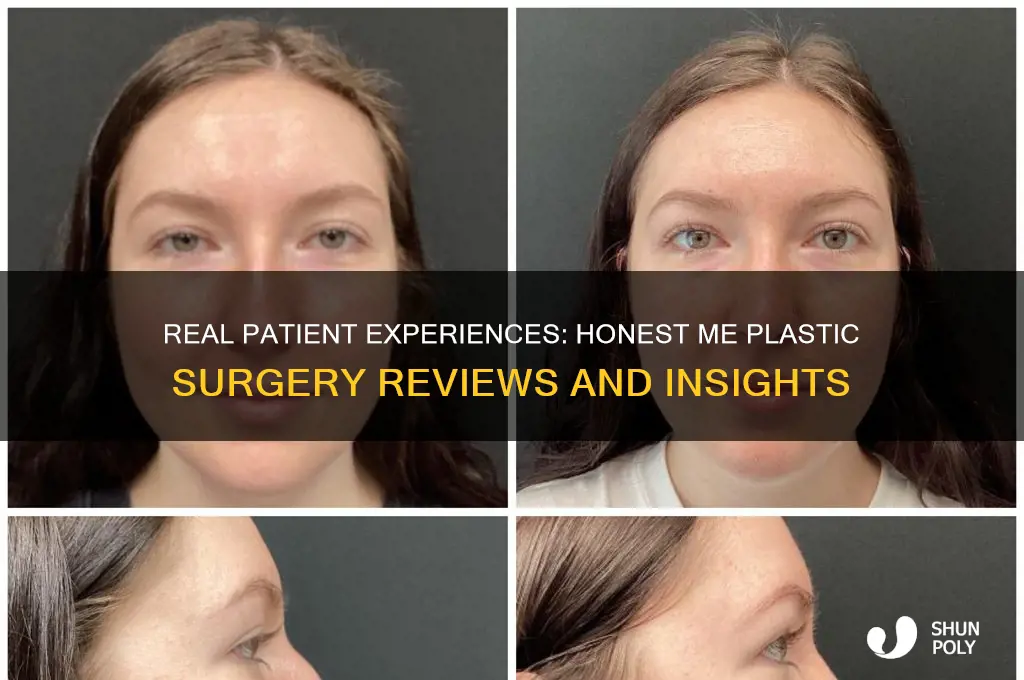 me plastic surgery reviews