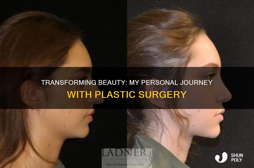 me plastic surgery
