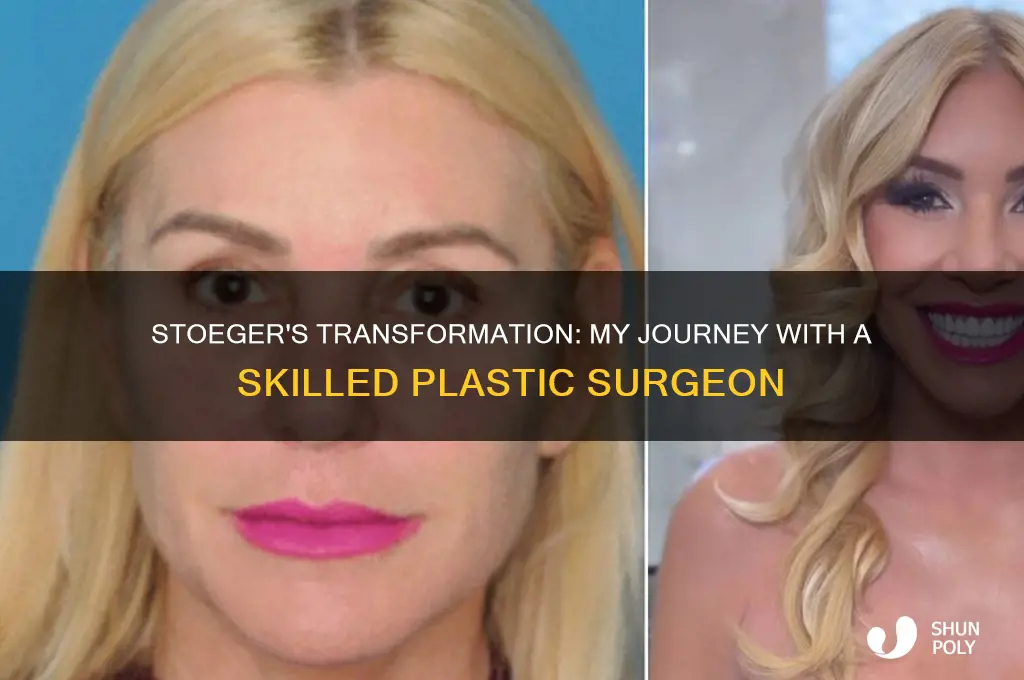 me stoeger my plastic surgeon