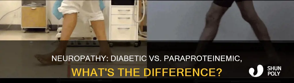 para neo plastic different than diabetic neuropathy