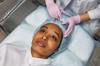plastic surgery