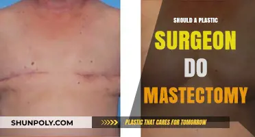 Plastic Surgeons Performing Mastectomies: Ethical and Practical Considerations