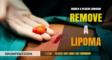 Should Plastic Surgeons Remove Lipomas? Expert Insights and Considerations
