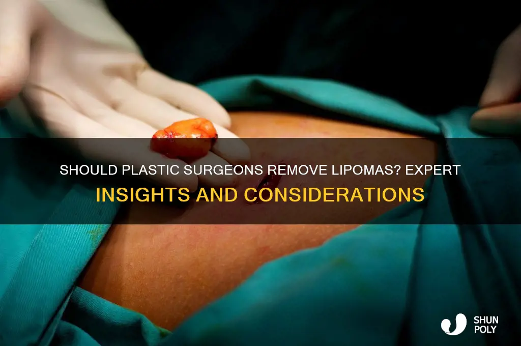 should a plastic surgeon remove a lipoma