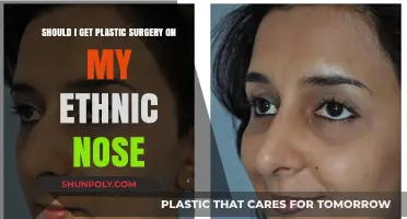 Embracing Your Ethnic Nose: Is Plastic Surgery the Right Choice?