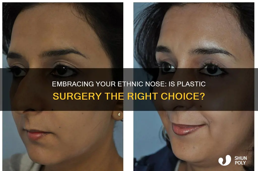should i get plastic surgery on my ethnic nose