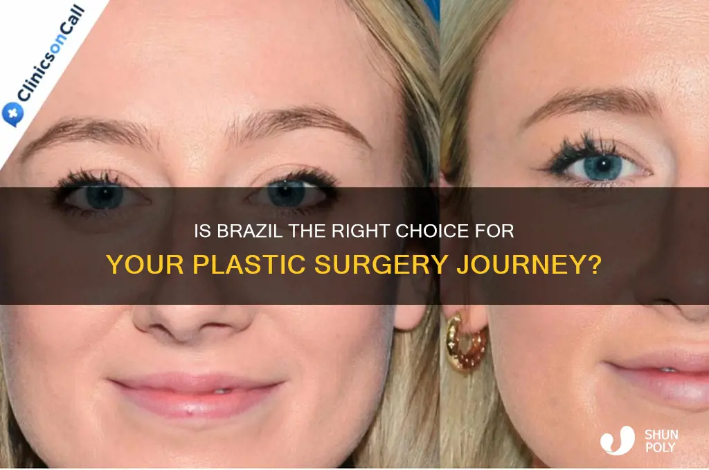 should i go to brazil for plastic surgery