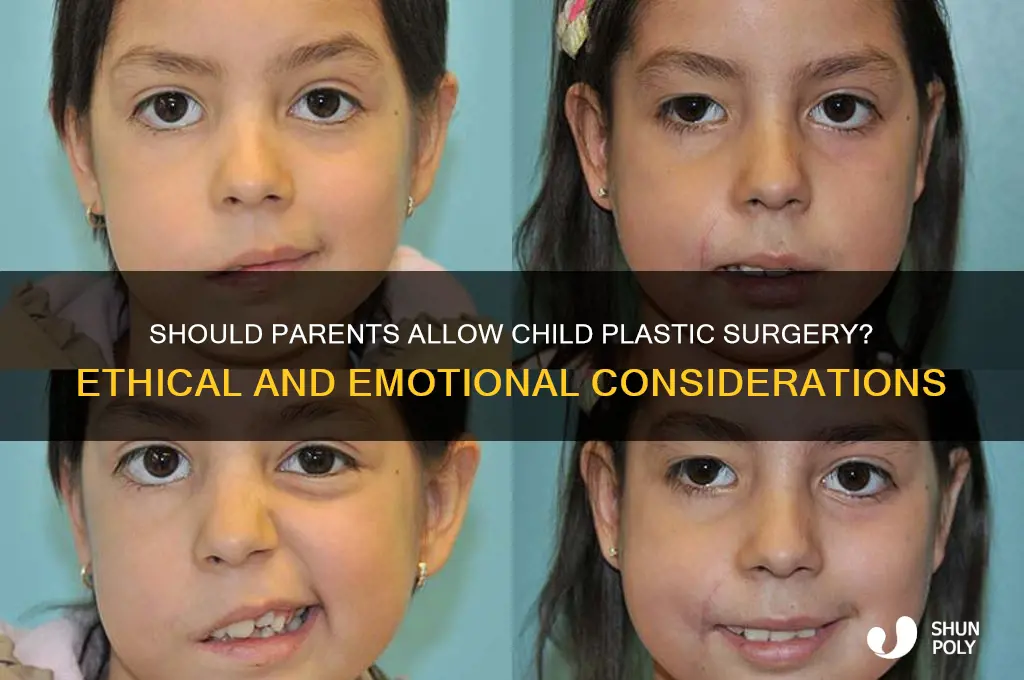 should parents allow their child a plastic surgery