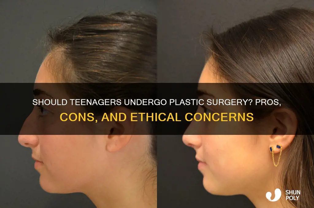 should teenagers be alowed to have plastic surgery essay