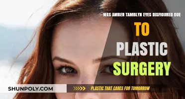 Amber Tamblyn's Eyes: Plastic Surgery Disfigurement Rumors Debunked