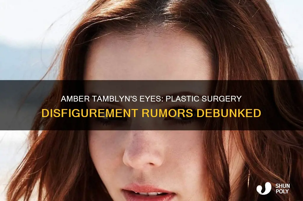 was amber tamblyn eyes disfigured due to plastic surgery