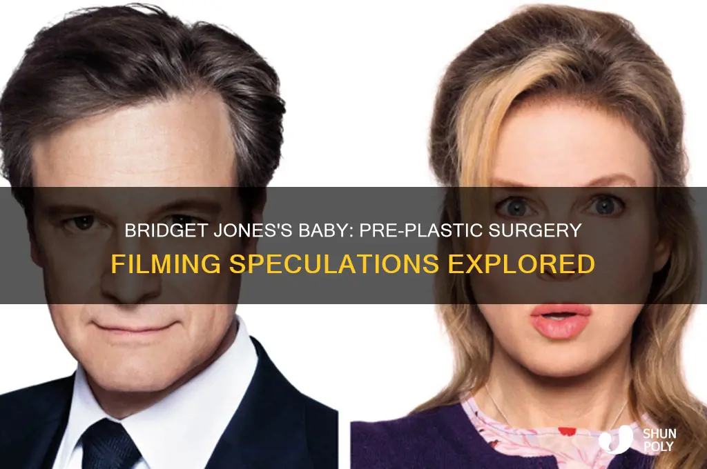 was bridget jones baby filmed before plastic surgery