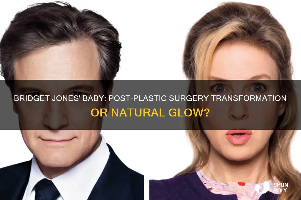 was bridget jones baby made after plastic surgery
