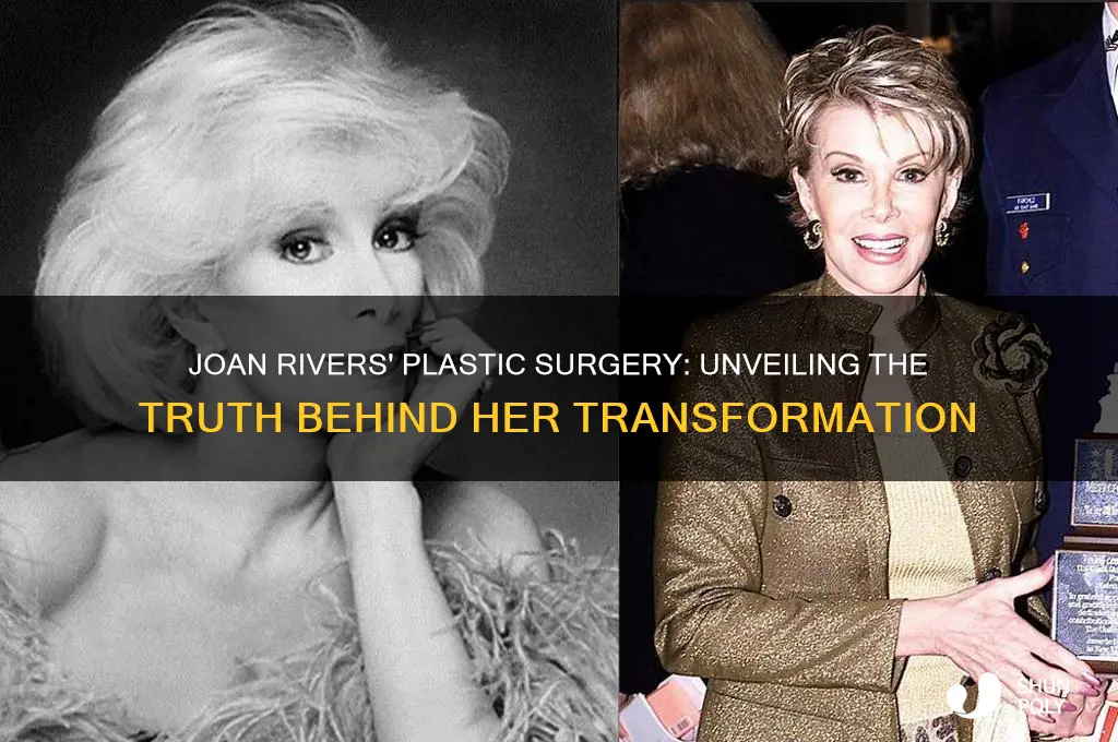 was joan rivers having plastic surgery
