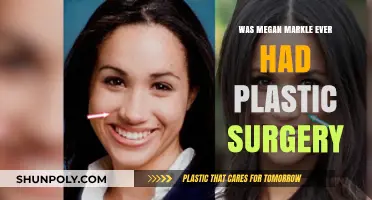 Megan Markle's Transformation: Plastic Surgery Speculations and Realities