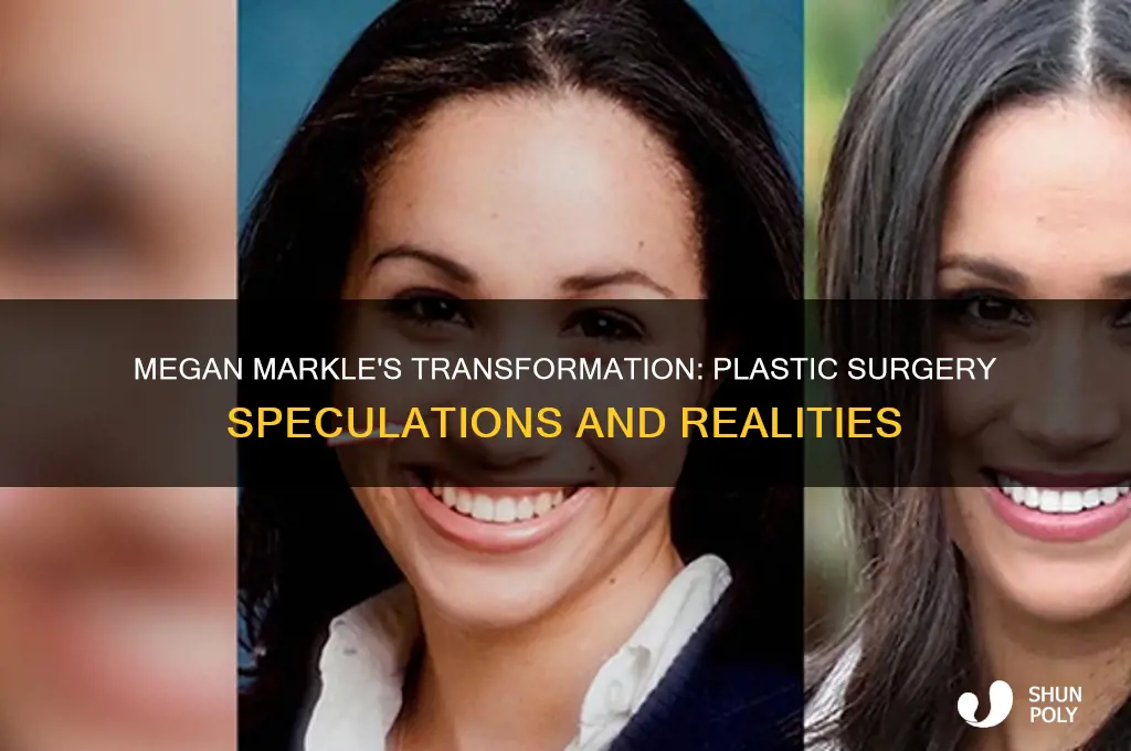 was megan markle ever had plastic surgery