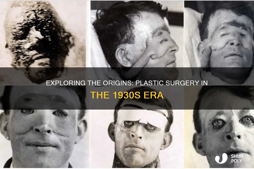 was plastic surgery arround in 1930
