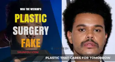 The Weeknd's Plastic Surgery: Fact or Fiction?