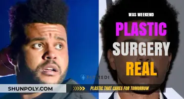Was Weekend Plastic Surgery Real? Uncovering the Truth Behind the Trend