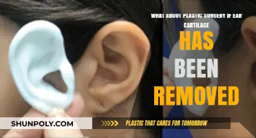 Ear Cartilage Removal: Plastic Surgery Options and Considerations