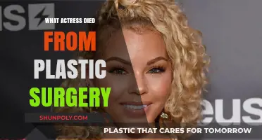 Tragic Beauty: Actress Who Lost Her Life to Plastic Surgery
