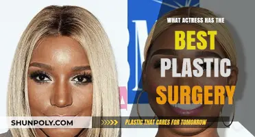 Hollywood's Top Plastic Surgery Transformations: Which Actress Nailed It?