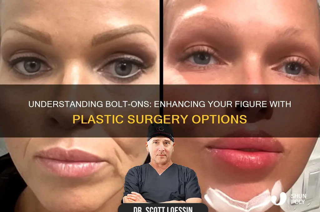 what are bolt ons plastic surgery