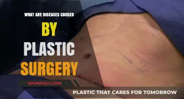 Plastic Surgery Risks: Understanding Diseases and Complications Post-Procedure