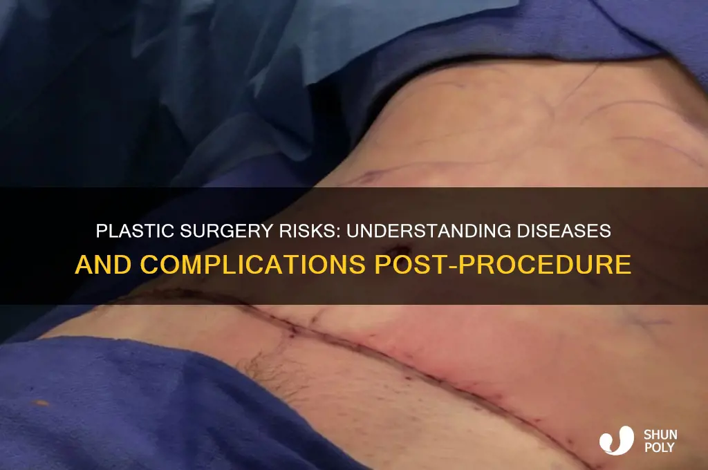what are diseases caused by plastic surgery