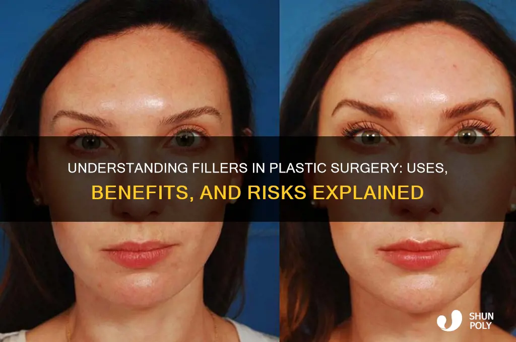 what are fillers in plastic surgery
